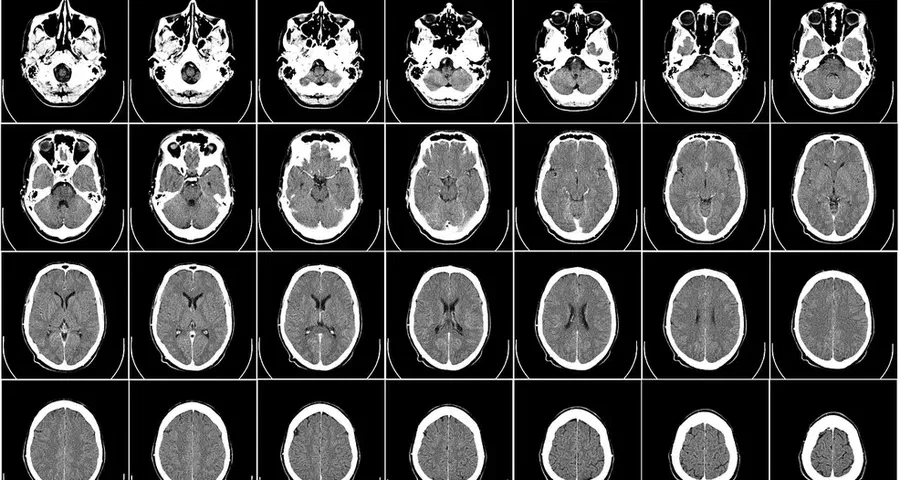 Can AI outperform medical professionals in diagnosis?
