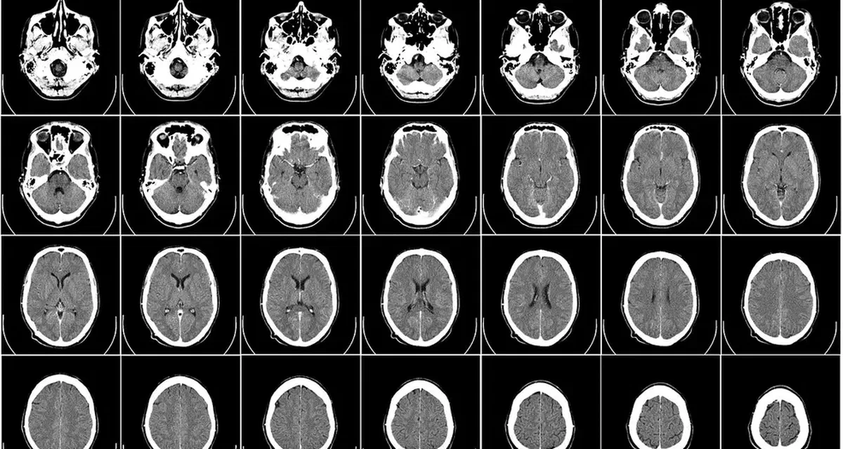 Can AI outperform medical professionals in diagnosis?